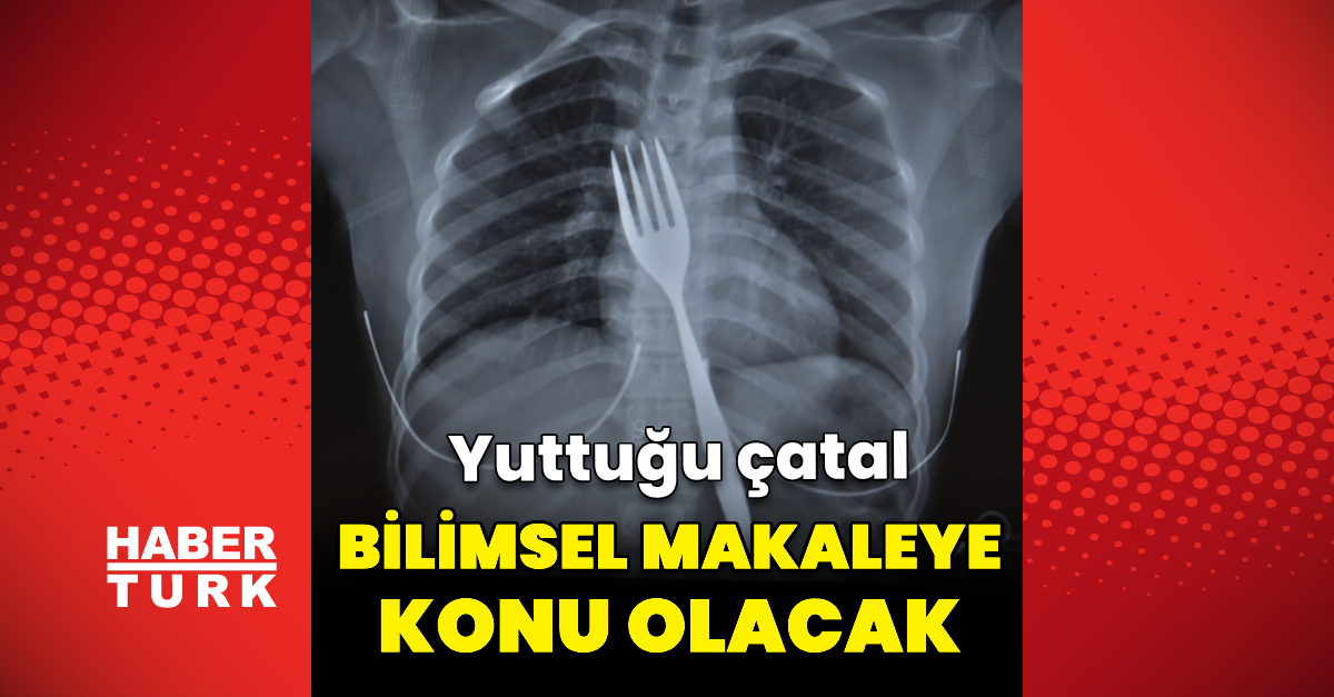 Yuttuğu çatal bilimsel makaleye konu olacak
